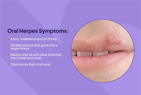 disease hermes|herpes simplex is caused by.